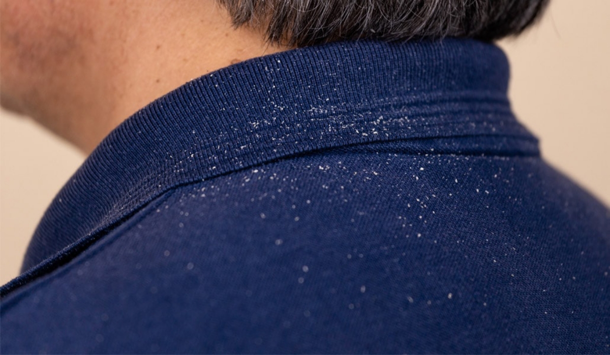 Iata care sunt 3 dintre cele mai vehiculate mituri despre matreata